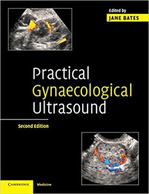 Practical Gynaecological Ultrasound 2nd Edition