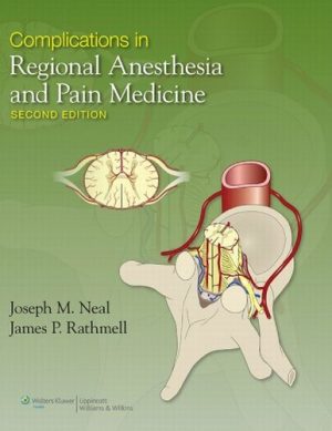 Complications in Regional Anesthesia And Pain Medicine 2nd Edition
