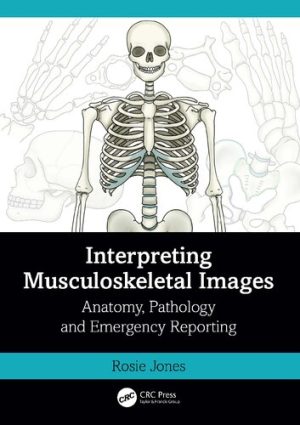 Interpreting Musculoskeletal Images Anatomy Pathology and Emergency Reporting