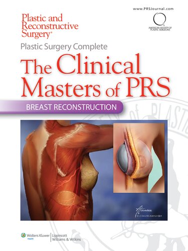Plastic Surgery Complete The Clinical Masters of PRS Breast Reconstruction