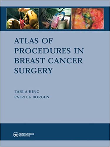 Atlas of Procedures in Breast Cancer Surgery
