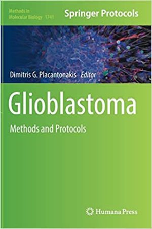 Glioblastoma Methods and Protocols