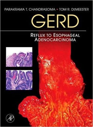 GERD Reflux to Esophageal Adenocarcinoma