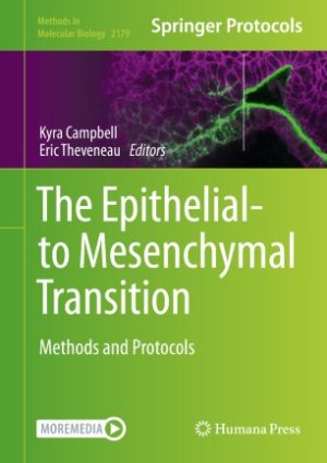 The Epithelial to Mesenchymal Transition Methods and Protocols