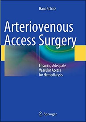 Arteriovenous Access Surgery Ensuring Adequate Vascular Access for Hemodialysis