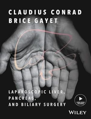 Laparoscopic Liver Pancreas and Biliary Surgery