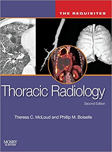 Thoracic Radiology The Requisites 2nd Edition