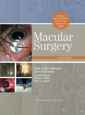 Macular Surgery 2nd Edition