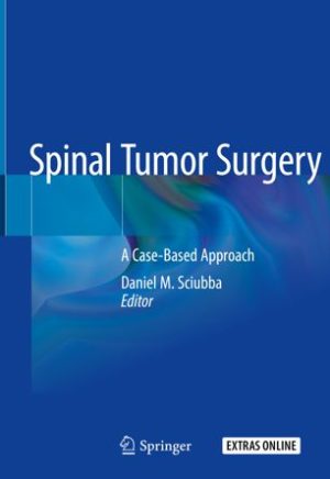 Spinal Tumor Surgery A Case Based Approach