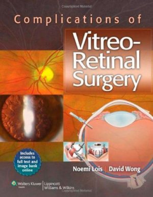 Complications of Vitreo Retinal Surgery