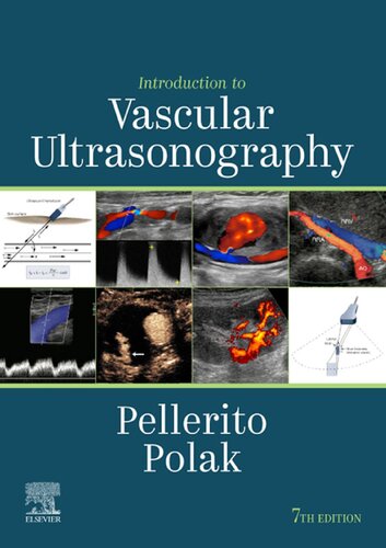 Introduction to Vascular Ultrasonography 7th Edition