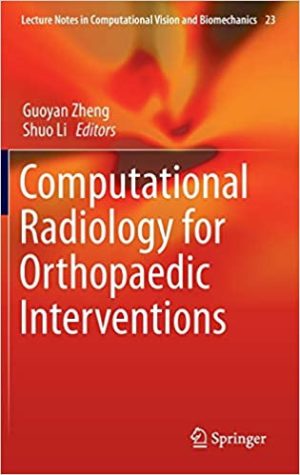 Computational Radiology for Orthopaedic Interventions