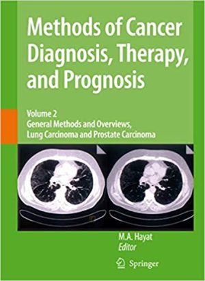 Methods of Cancer Diagnosis Therapy and Prognosis Volume 2 General Methods and Overviews Lung Carcinoma and Prostate Carcinoma