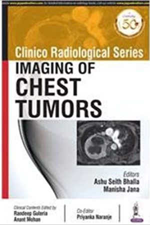 Clinico Radiological Series Imaging of Chest Tumors