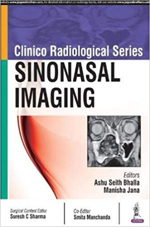 Clinico Radiological Series Sinonasal Imaging