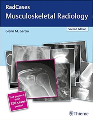 Radcases Musculoskeletal Radiology 2nd Edition