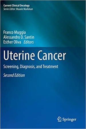 Uterine Cancer Screening Diagnosis and Treatment 2nd Edition