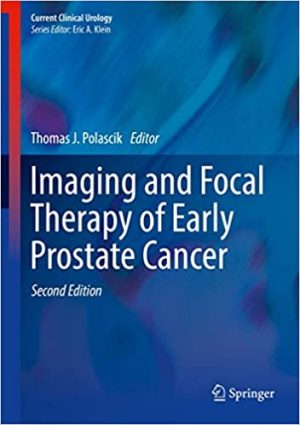 Imaging and Focal Therapy of Early Prostate Cancer 2nd Ed