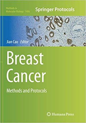 Breast Cancer Methods and Protocols