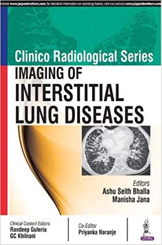 Clinico Radiological Series Imaging of Interstitial Lung Diseases
