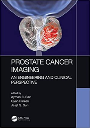 Prostate Cancer Imaging An Engineering and Clinical Perspective