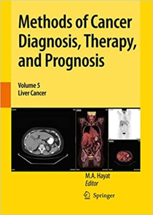 Methods of Cancer Diagnosis Therapy and Prognosis Volume 5 Liver Cancer