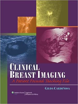 Clinical Breast Imaging A Patient Focused Teaching