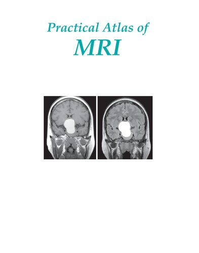 Practical Atlas of MRI