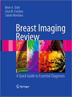 Breast Imaging Review A Quick Guide to Essential Diagnoses