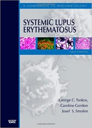 Systemic Lupus Erythematosus A Companion to Rheumatology