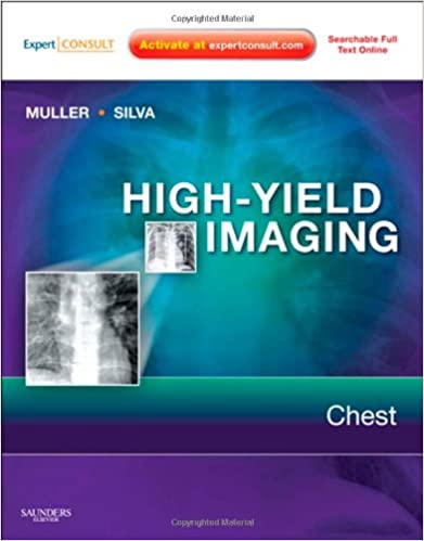 High Yield Imaging Chest