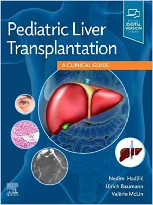 Pediatric Liver Transplantation A Clinical Guide