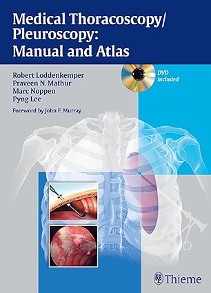 Medical Thoracoscopy Pleuroscopy Manual and Atlas