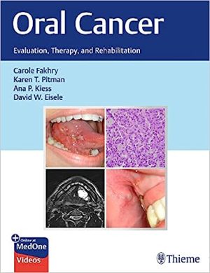 Oral Cancer Evaluation Therapy and Rehabilitation