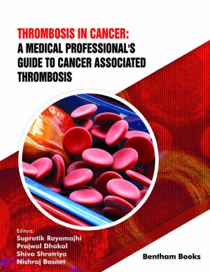 Thrombosis in Cancer A Medical Professionals Guide to Cancer Associated Thrombosis
