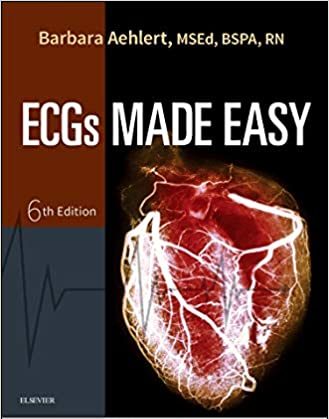 ECGs Made Easy By Barbara Aehlert 6th Edition