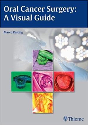 Oral Cancer Surgery A Visual Guide