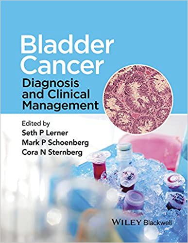 Bladder Cancer Diagnosis and Clinical Management