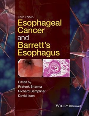 Esophageal Cancer and Barretts Esophagus 3rd Edition