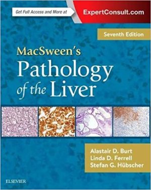 MacSweens Pathology of the Liver 7th Ed