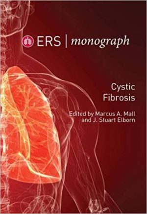 Cystic Fibrosis By Marcus A Mall