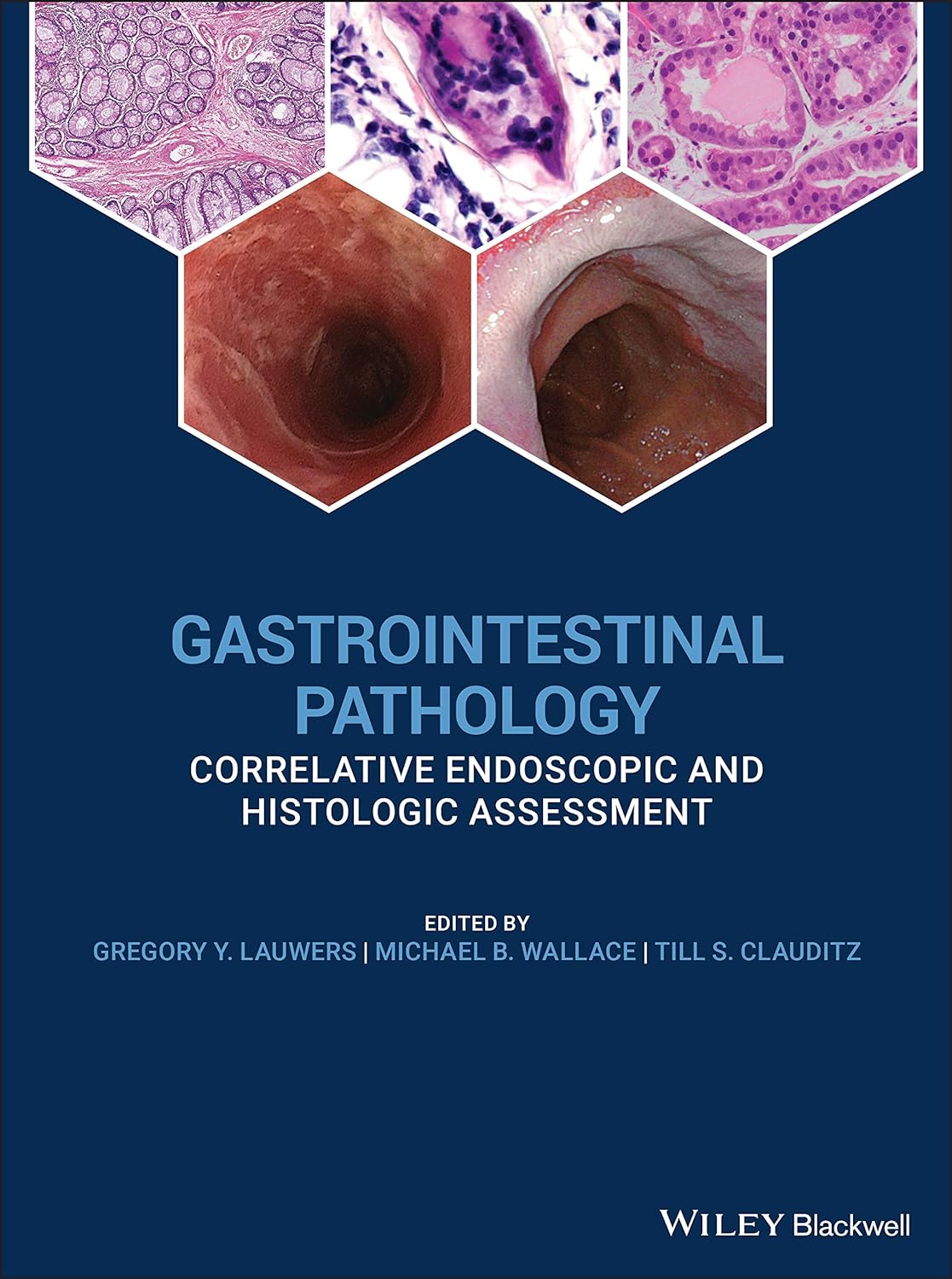 Gastrointestinal Pathology Correlative Endoscopic and Histologic Assessment