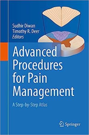 Advanced Procedures for Pain Management A Step by Step Atlas