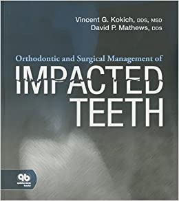 Orthodontic and Surgical Management of Impacted Teeth