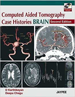 Computed Aided Tomography Case Histories BRAIN 2nd Edition