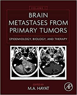 Brain Metastases from Primary Tumors Volume 1 Epidemiology Biology and Therapy