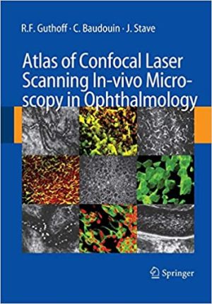 Atlas of Confocal Laser Scanning In Vvivo Microscopy in Ophthalmology