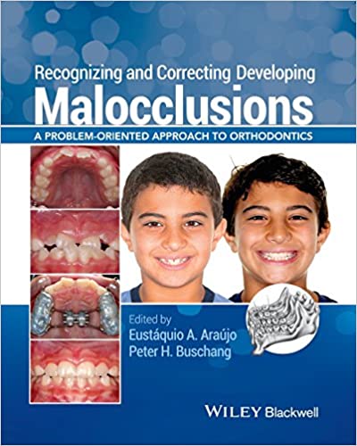 Recognizing and Correcting Developing Malocclusions A Problem Oriented Approach to Orthodontics