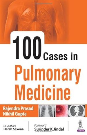 100 Cases in Pulmonary Medicine