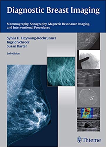 Diagnostic Breast Imaging Mammography Sonography MRI and Interventional Procedures 3rd Ed
